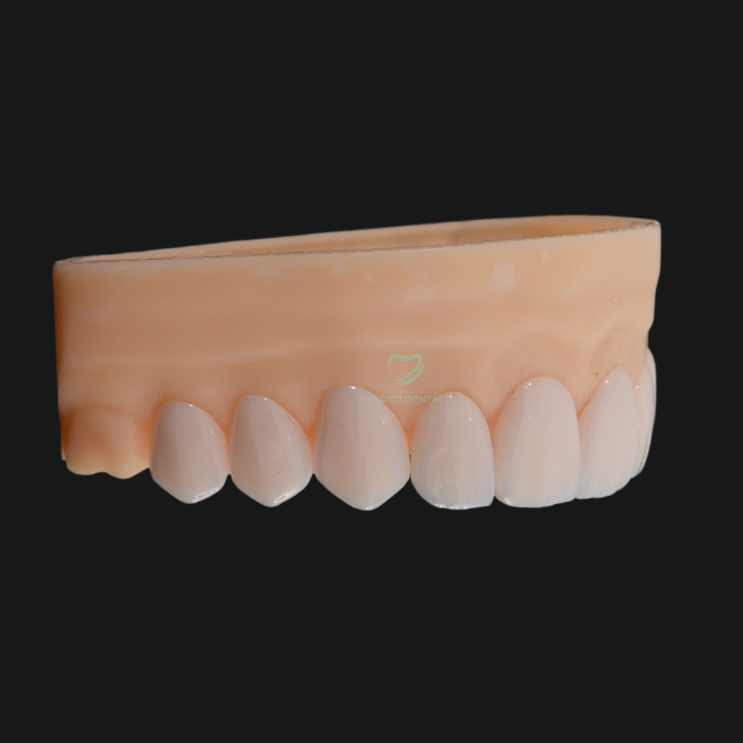 Facetas E-max